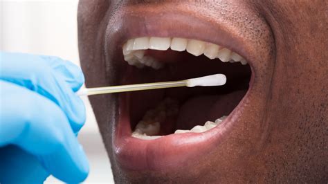 The process detects drug use up to 48 hours from time of collection. . What does it mean when a mouth swab drug test turns red